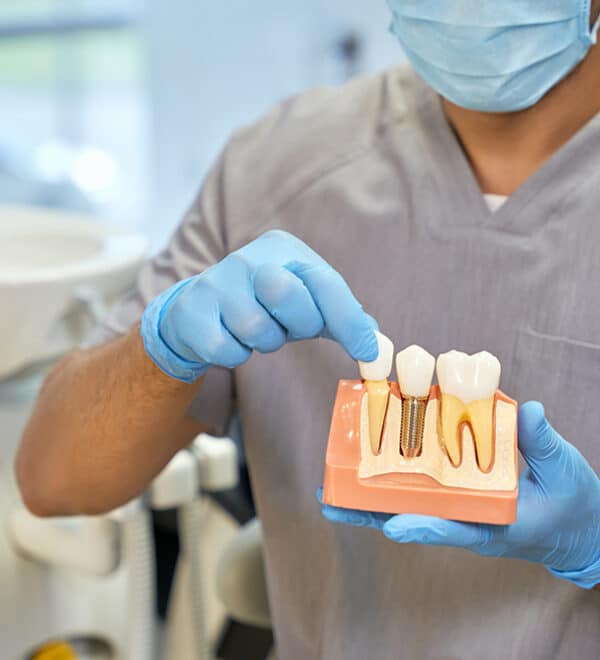 Dental implants procedure illustrated with high precision tools and a 3D dental implant model showcasing the stages of implantation in a dentist's office in Oakland, NJ –– highlighting advanced dentistry techniques for tooth replacement.